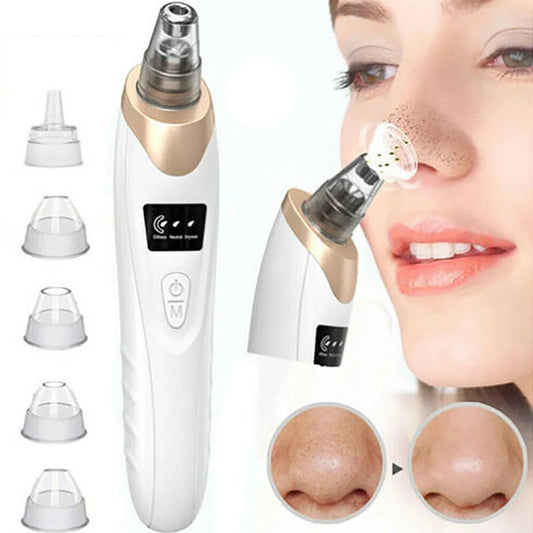 Facial Beauty Electric Vacuum Blackhead Remover Nose Acne Removal